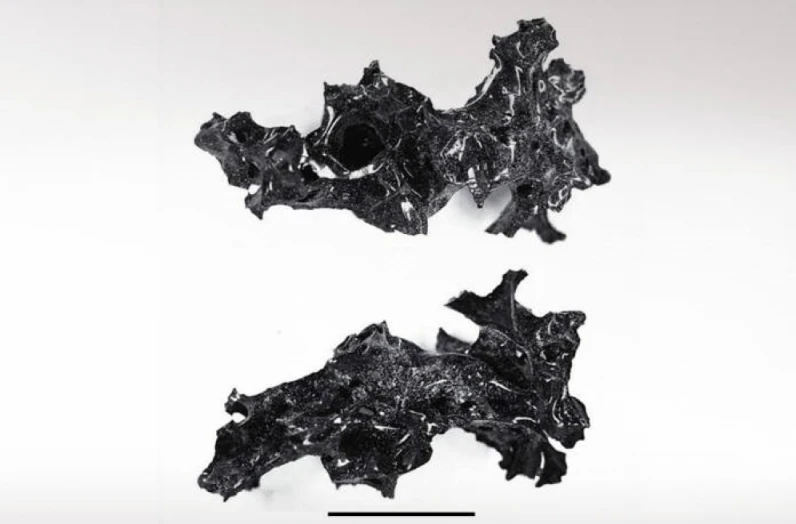 εγκέφαλο ενός άνδρα σε γυαλί